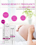 Stretch marks and pregnancy marks removal cream