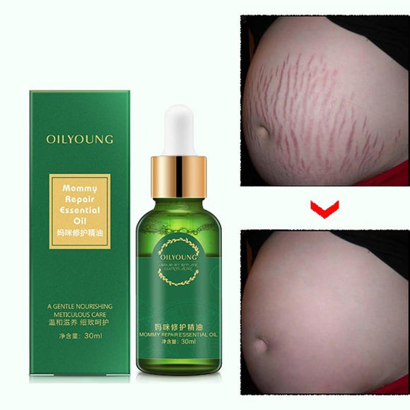 Stretch Marks Remover Essential Oil Treatment